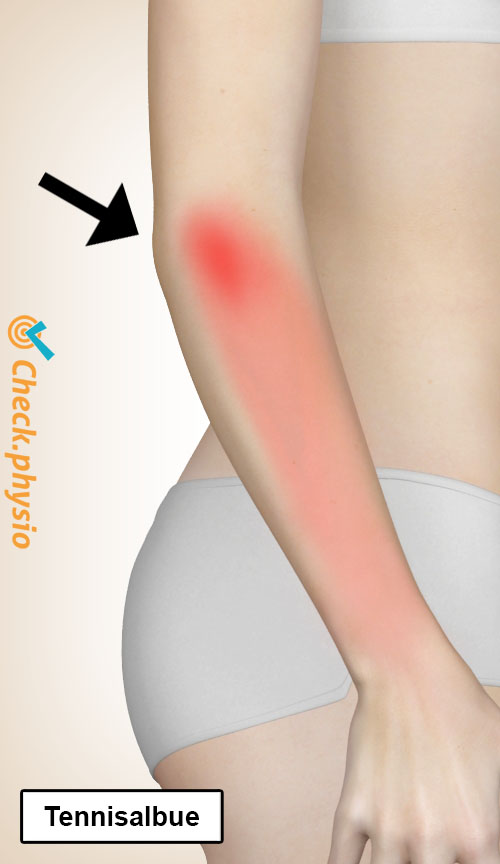arm tennisalbue lokasjon