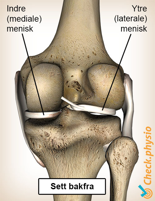 kne menisk bakside