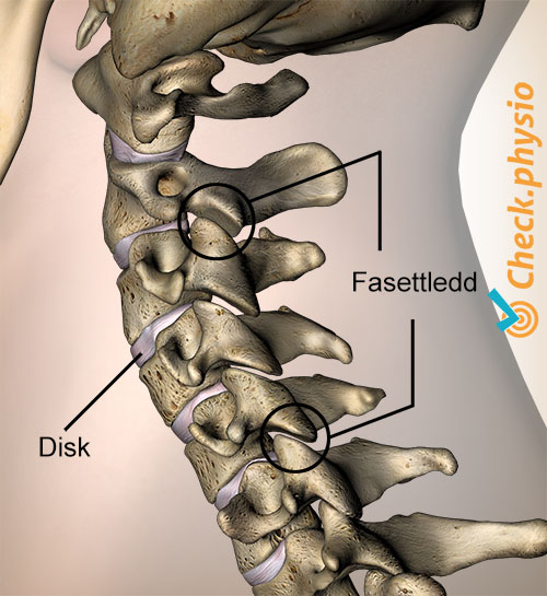 nakke fasettledd sidevisning lateral skive