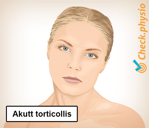 nakke torticollis feilstilling