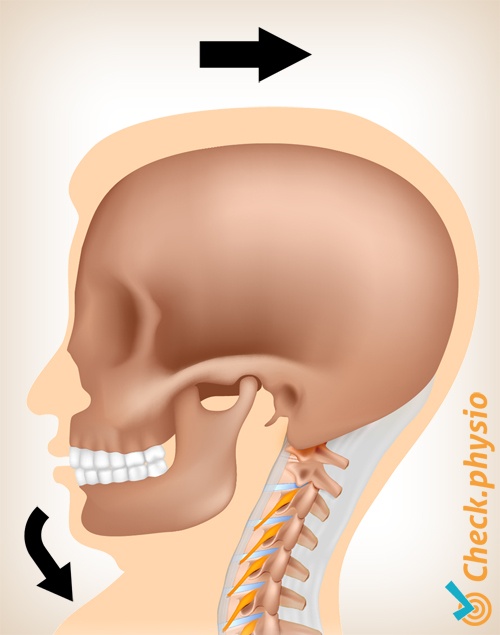 nakke whiplash smerte bevegelse 1
