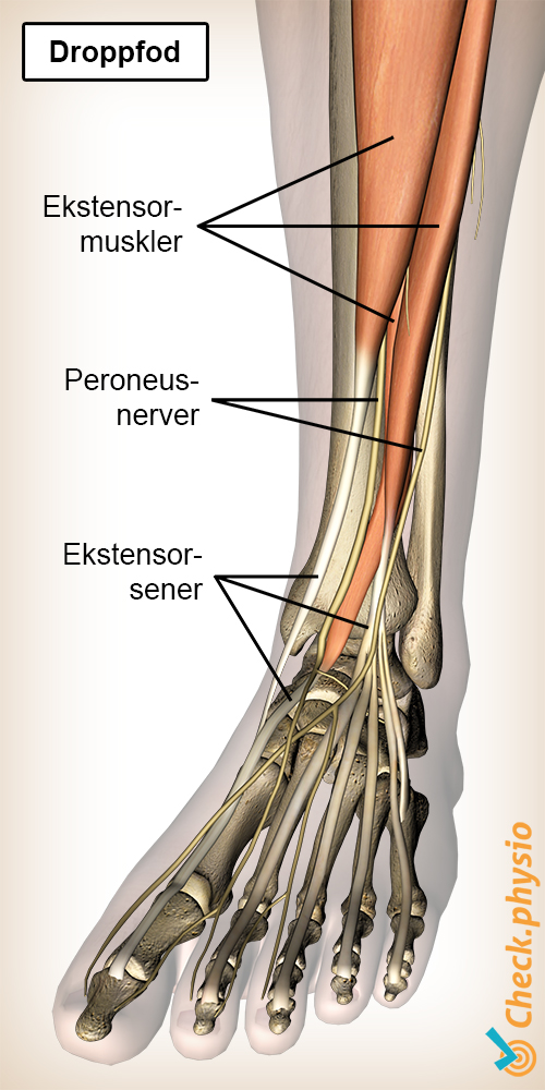 legg droppfot peroneus nerver fotløfter muskler sener