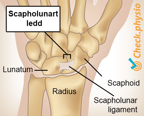 håndledd scapholunært ledd