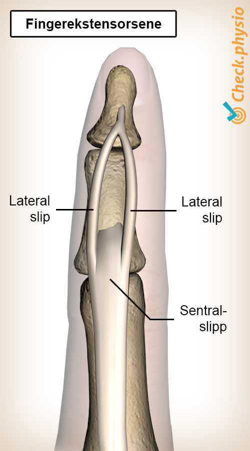 finger strekkesene slip sentral lateralslip