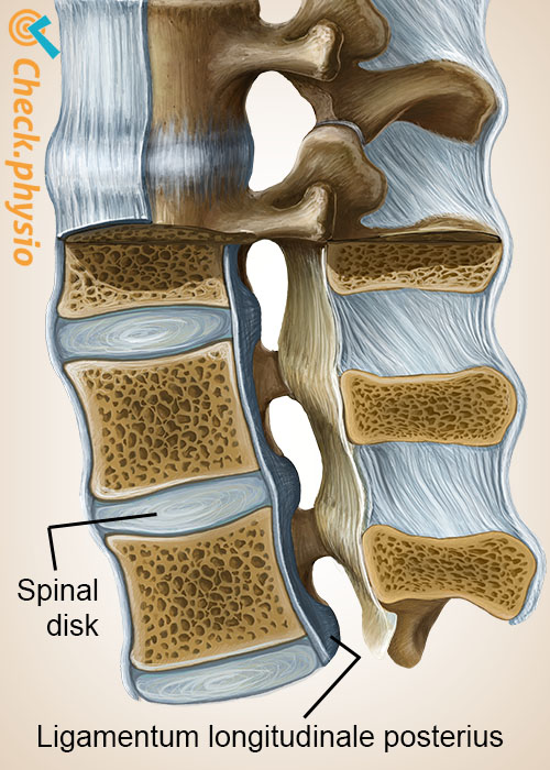 ryggrad ryggsøyle ligamentum longitudinale posterius mellomvirvelskive discus