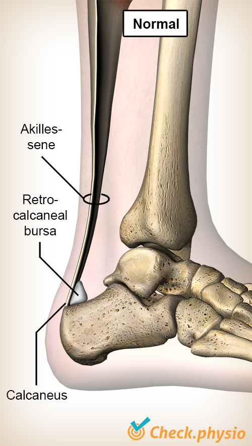 ankel akillessene bursa retrocalcanea hælben calcaneus