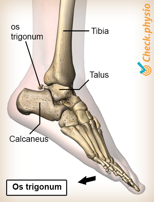 ankel bakre impingement os trigonum