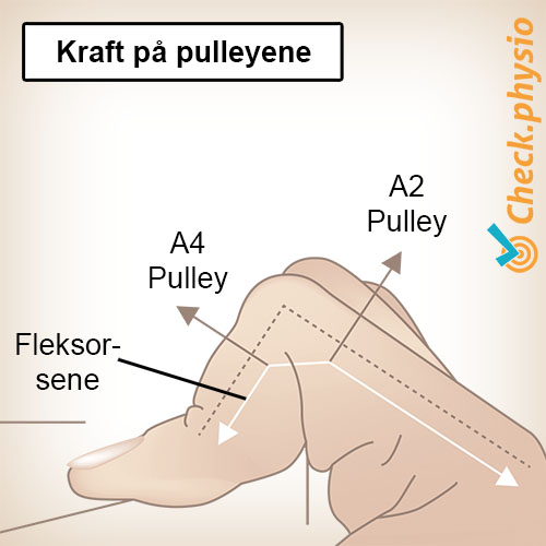 hånd finger trinser trekkrefter